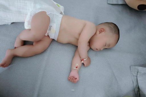 万宁宝宝脸上有白色斑块